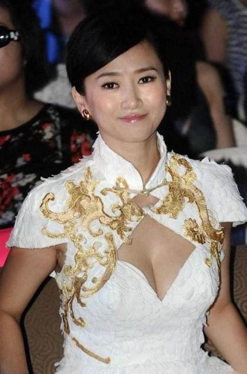 整容 翁虹在线观看,揭秘明星蜕变之路 第3张 整容 翁虹在线观看,揭秘明星蜕变之路 第3张